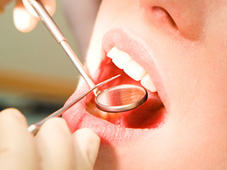 虫歯治療と並行して矯正治療ができるセラミック矯正